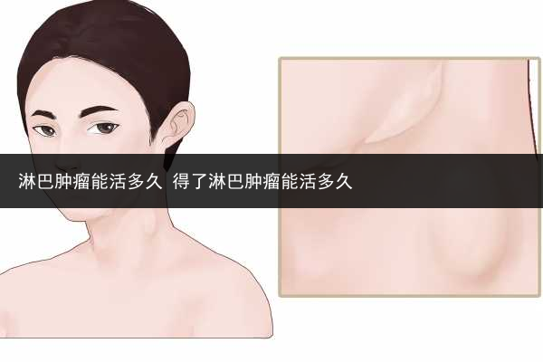 淋巴腫瘤能活多久 得了淋巴腫瘤能活多久