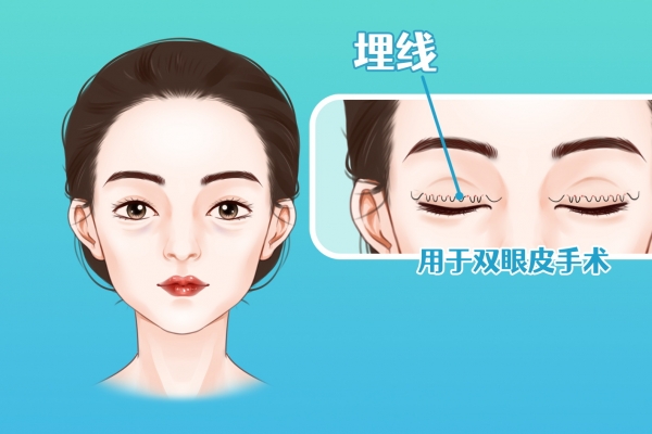 ?割雙眼皮哪個(gè)醫(yī)院比較好 割雙眼皮比較好的醫(yī)院有哪些